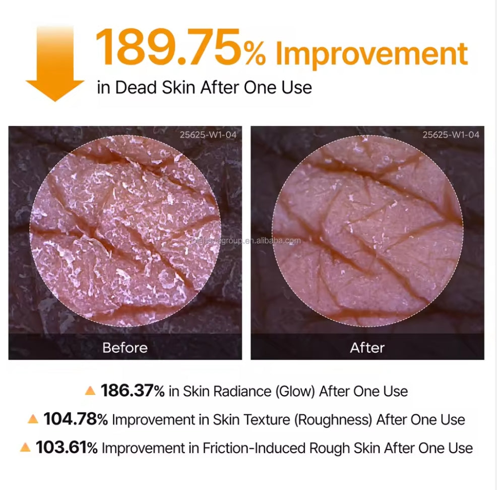 Solivène™ Peel Shot Keratin Care Kojic Acid Turmeric Spray