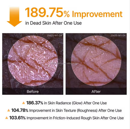 Solivène™ Peel Shot Keratin Care Kojic Acid Turmeric Spray